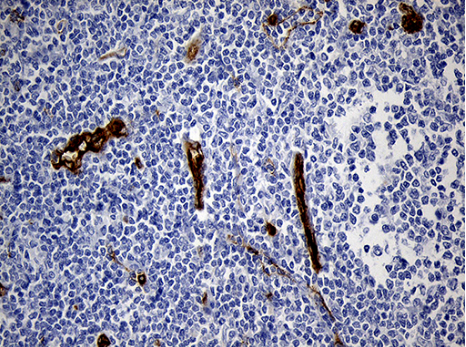 TSPAN7 Antibody