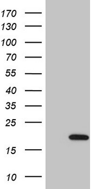 UBE2D2 Antibody