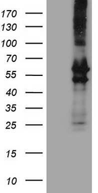 Peripherin Antibody