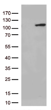 Glucocorticoid Receptor Antibody