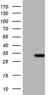 MRRF Antibody