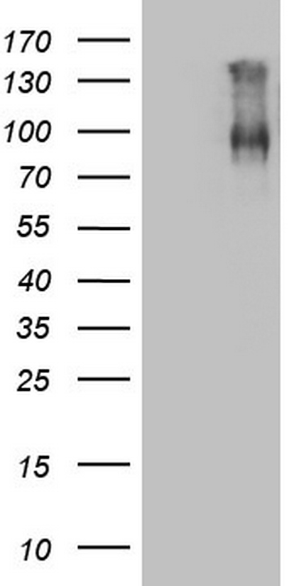 Factor XIII Antibody