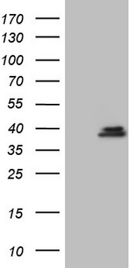 Gemin 8 Antibody