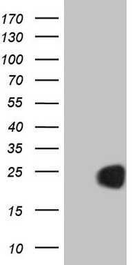 CETN3 Antibody