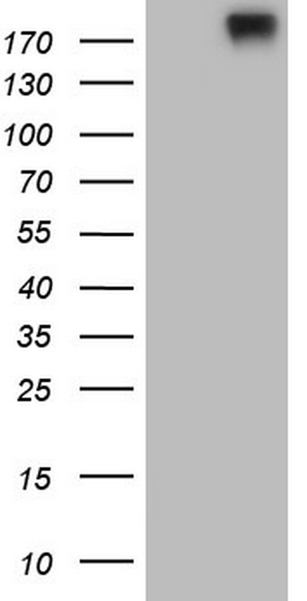 RET Antibody
