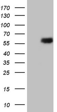 Estrogen Related Receptor beta Antibody