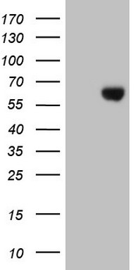 Estrogen Related Receptor beta Antibody