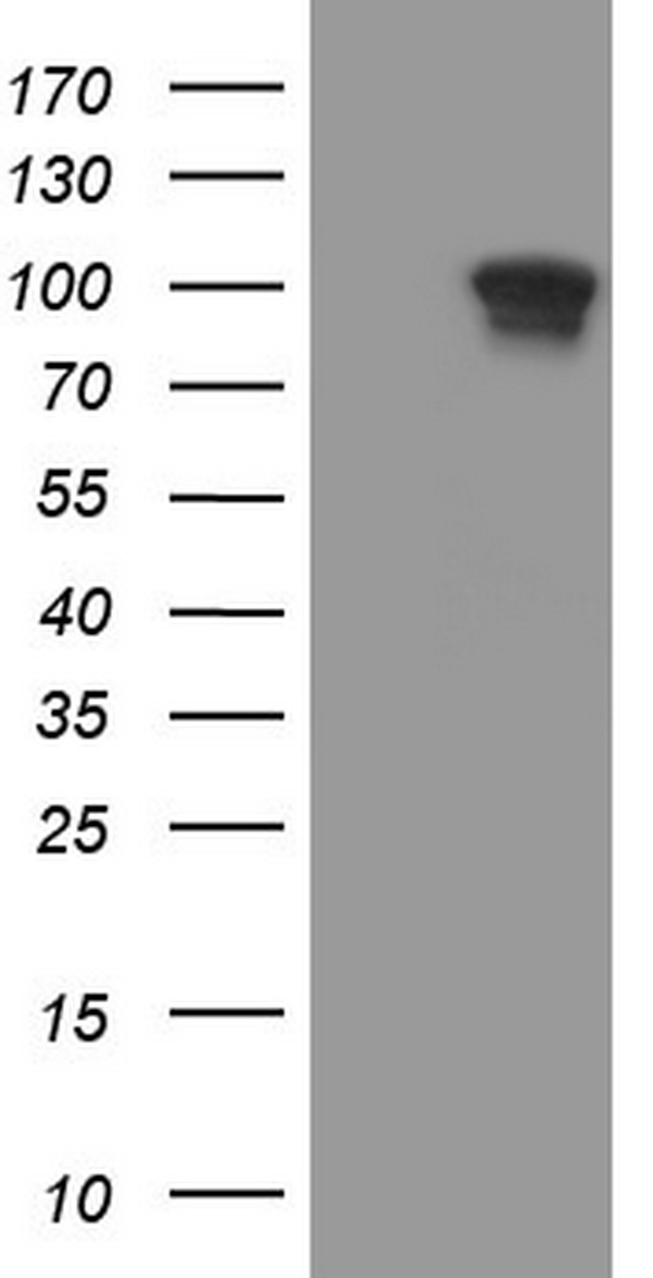 CD56 Antibody