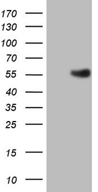 Estrogen Related Receptor beta Antibody