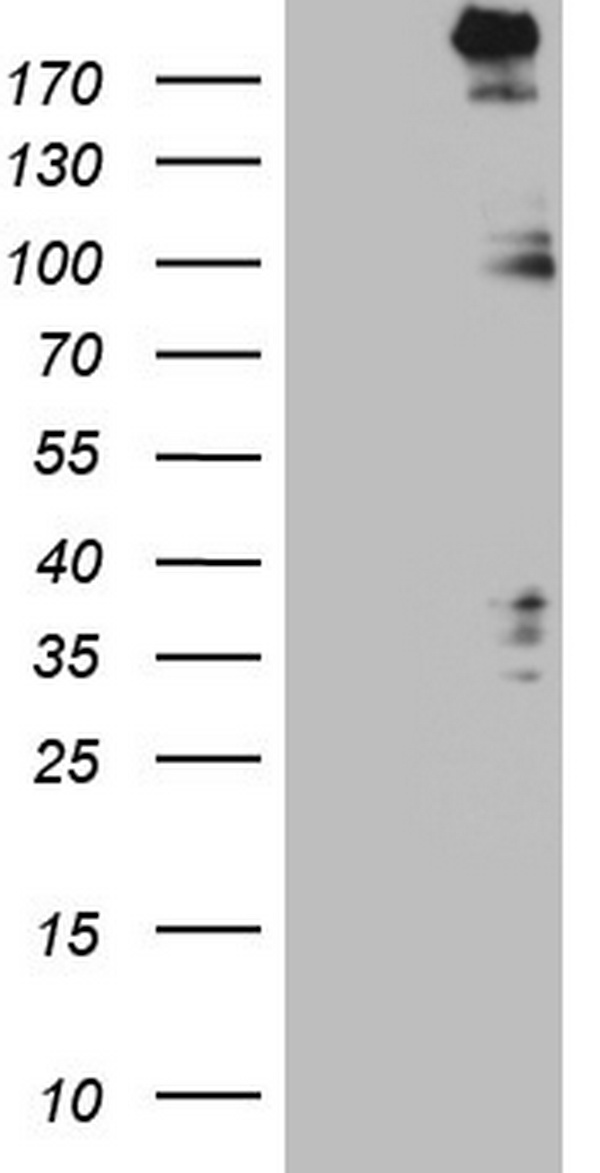 SETD1A Antibody