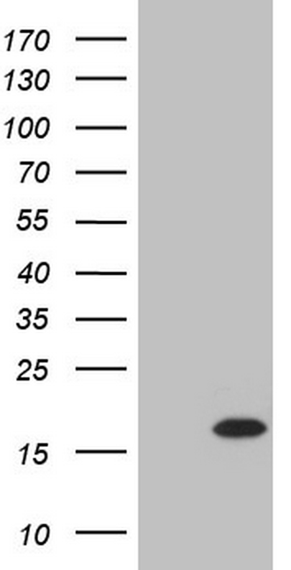 TWIST2 Antibody