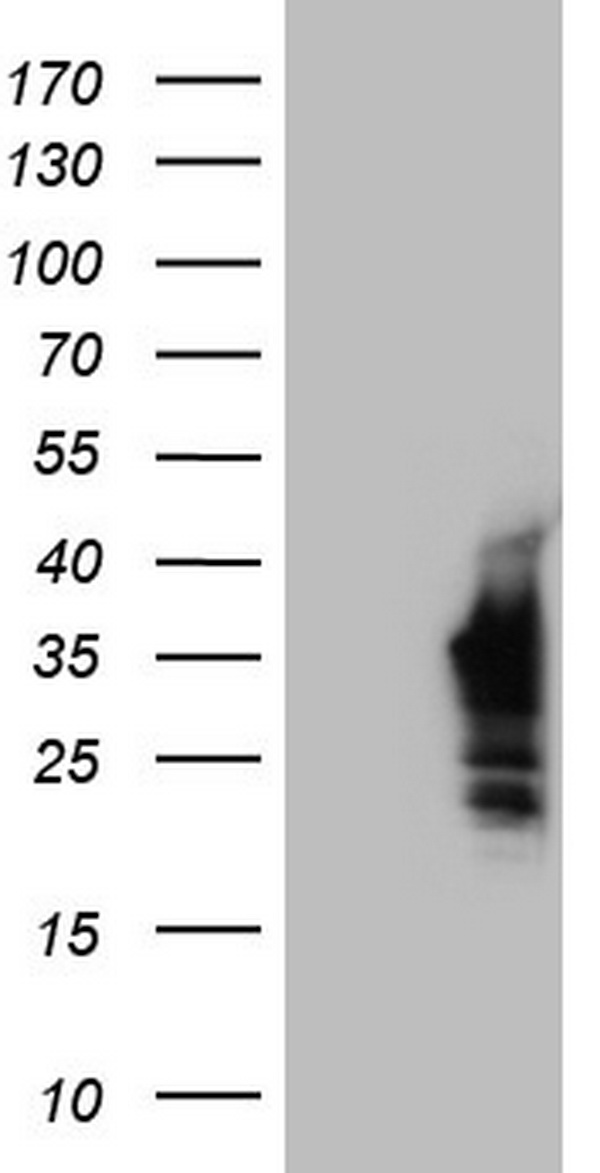Nkx3.1 Antibody