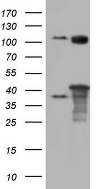 NIPP1 Antibody
