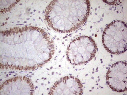 NIPP1 Antibody