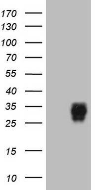 Adiponectin Antibody