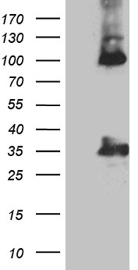 Calretinin Antibody