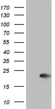 Centrin 1 Antibody
