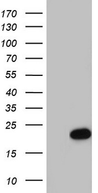 Centrin 1 Antibody