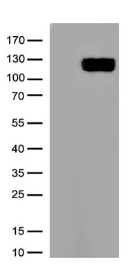 Angiotensin Converting Enzyme 2 Antibody