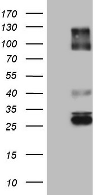 IGSF11 Antibody