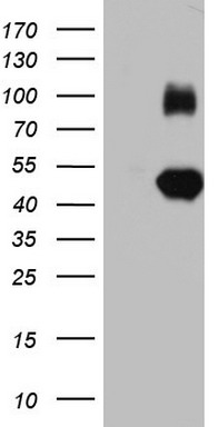 IGSF11 Antibody