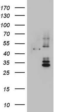 DDOST Antibody