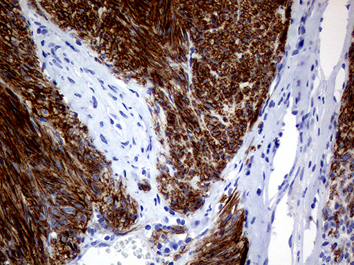 TMEM16A Antibody