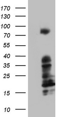 bcl 6 Antibody
