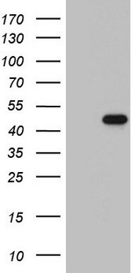 TTF1 Antibody