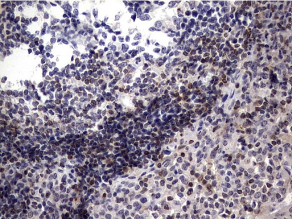 BCL2 Antibody