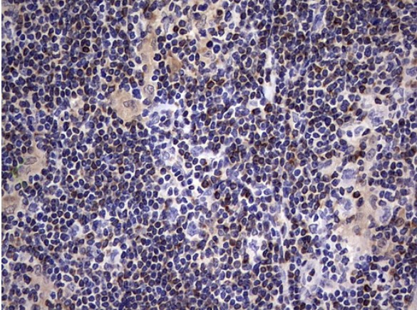 BCL2 Antibody