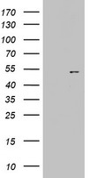 Cytokeratin 20 Antibody