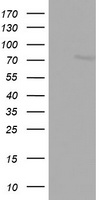 FBXO11 Antibody