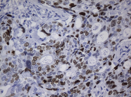 Ki67 Antibody