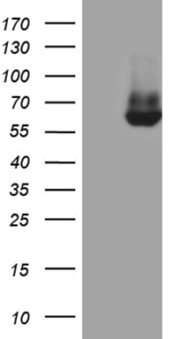 Estrogen Receptor beta Antibody
