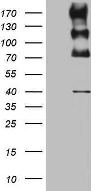 ALK Antibody