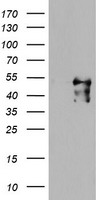 Meis homeobox 3 Antibody