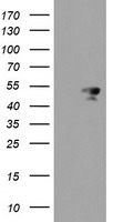 Meis homeobox 3 Antibody