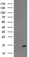 TPRKB Antibody
