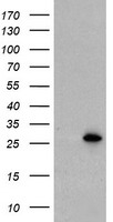 UBE2E3 Antibody