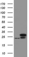 UBE2E3 Antibody