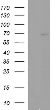 Albumin Antibody