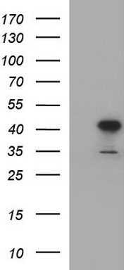 HAUS7 Antibody