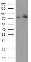 Hydroxysteroid (17 beta) Dehydrogenase 4 Antibody