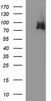 Hydroxysteroid (17 beta) Dehydrogenase 4 Antibody