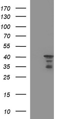HERPUD1 Antibody