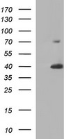 UPRT Antibody