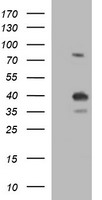 UPRT Antibody