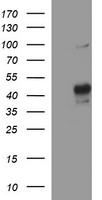 MMP13 Antibody