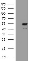 MMP13 Antibody